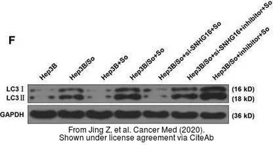 Anti-LC3A antibody [166AT1234] used in Western Blot (WB). GTX17380