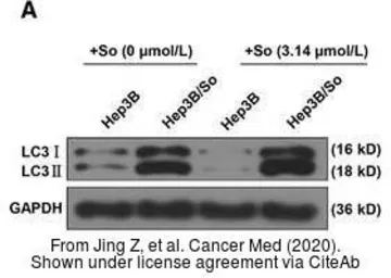 Anti-LC3A antibody [166AT1234] used in Western Blot (WB). GTX17380