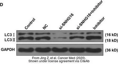 Anti-LC3A antibody [166AT1234] used in Western Blot (WB). GTX17380