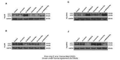 Anti-LC3A antibody [166AT1234] used in Western Blot (WB). GTX17380