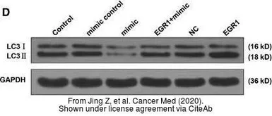 Anti-LC3A antibody [166AT1234] used in Western Blot (WB). GTX17380