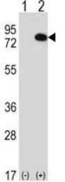 Anti-RIOK1 antibody used in Western Blot (WB). GTX17382