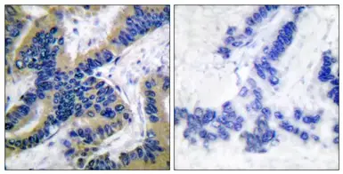 Anti-Caspase 6 (cleaved Asp179) antibody used in IHC (Paraffin sections) (IHC-P). GTX17383