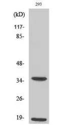 Anti-Caspase 6 (cleaved Asp179) antibody used in Western Blot (WB). GTX17383