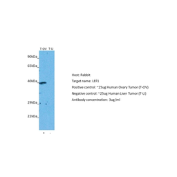 Anti-LEF1 antibody used in Western Blot (WB). GTX17431
