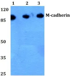 Anti-M-Cadherin antibody used in Western Blot (WB). GTX17434
