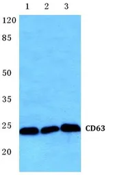 Anti-CD63 antibody used in Western Blot (WB). GTX17441