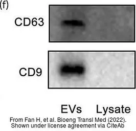 Anti-CD63 antibody used in Western Blot (WB). GTX17441