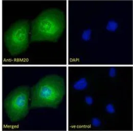 Anti-RBM20 antibody used in Immunocytochemistry/ Immunofluorescence (ICC/IF). GTX17481