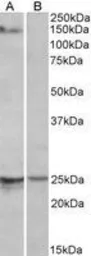 Anti-RBM20 antibody used in Western Blot (WB). GTX17481