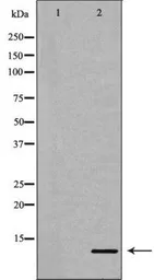 Anti-CXCL8 / IL8 antibody used in Western Blot (WB). GTX17483