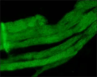 Anti-Myosin skeletal fast antibody [MY-32] used in IHC (Paraffin sections) (IHC-P). GTX17485