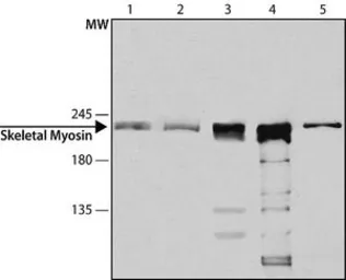 Anti-Myosin skeletal fast antibody [MY-32] used in Western Blot (WB). GTX17485