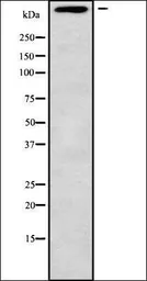 Anti-MUC5B antibody used in Western Blot (WB). GTX17503