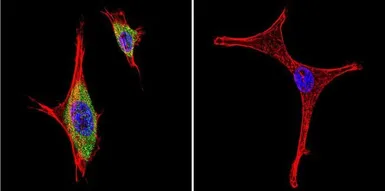 Anti-iNOS antibody used in Immunocytochemistry/ Immunofluorescence (ICC/IF). GTX17504
