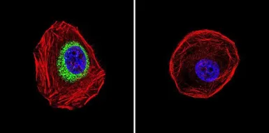 Anti-iNOS antibody used in Immunocytochemistry/ Immunofluorescence (ICC/IF). GTX17504