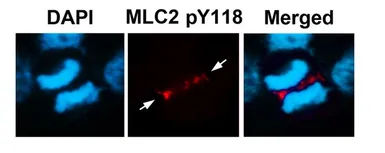 Anti-Myosin Light Chain 2 (MLC-2v) (phospho Tyr118) antibody used in Immunocytochemistry/ Immunofluorescence (ICC/IF). GTX17511