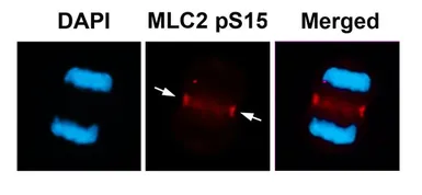Anti-Myosin Light Chain 2 (MLC-2v) (phospho Ser15) antibody used in Immunocytochemistry/ Immunofluorescence (ICC/IF). GTX17513