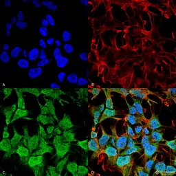 Anti-GABA A Receptor alpha 5 antibody [S415-24] used in Immunocytochemistry/ Immunofluorescence (ICC/IF). GTX17517