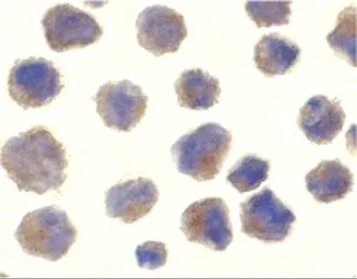 Anti-BACE1 antibody used in Immunocytochemistry/ Immunofluorescence (ICC/IF). GTX17545