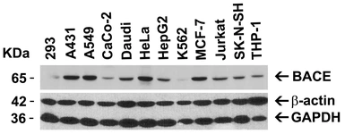 Anti-BACE1 antibody used in Western Blot (WB). GTX17545