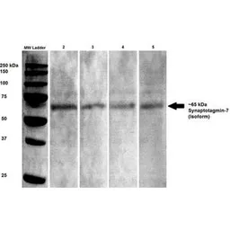 Anti-Synaptotagmin 7 antibody [S275-14] used in Western Blot (WB). GTX17546