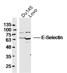 Anti-CD62E antibody used in Western Blot (WB). GTX17548