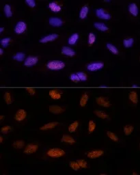 Anti-ADNP antibody used in Immunocytochemistry/ Immunofluorescence (ICC/IF). GTX17559