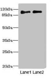 Anti-ICAM5 antibody used in Western Blot (WB). GTX17563