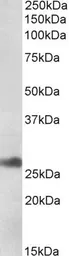 Anti-DNAJB9 antibody used in Western Blot (WB). GTX17566