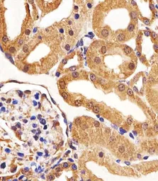 Anti-VEGF Receptor 3 antibody [818CT12.1.1] used in IHC (Paraffin sections) (IHC-P). GTX17567