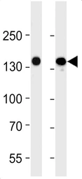 Anti-VEGF Receptor 3 antibody [818CT12.1.1] used in Western Blot (WB). GTX17567