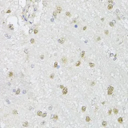 Anti-CMAS antibody used in IHC (Paraffin sections) (IHC-P). GTX17569