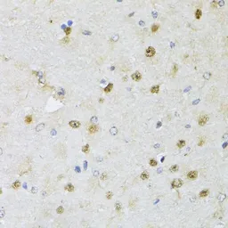 Anti-CMAS antibody used in IHC (Paraffin sections) (IHC-P). GTX17569