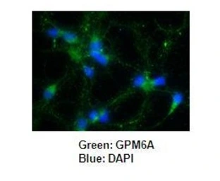 Anti-GPM6A antibody used in Immunocytochemistry/ Immunofluorescence (ICC/IF). GTX17572