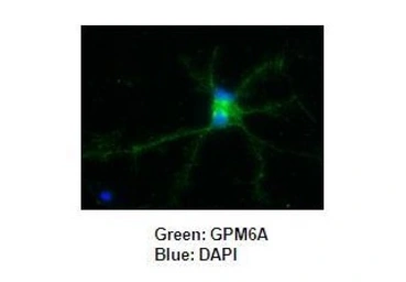 Anti-GPM6A antibody used in Immunocytochemistry/ Immunofluorescence (ICC/IF). GTX17572