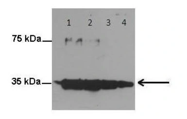 Anti-GPM6A antibody used in Western Blot (WB). GTX17572