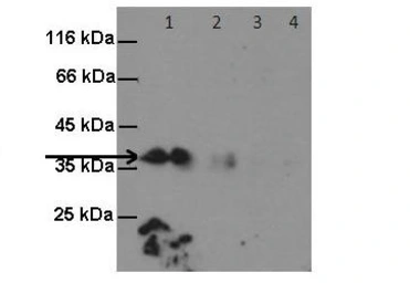 Anti-GPM6A antibody used in Western Blot (WB). GTX17572