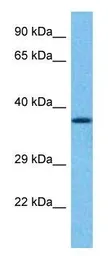 Anti-GPM6A antibody used in Western Blot (WB). GTX17572
