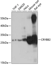 Anti-beta B2 Crystallin antibody used in Western Blot (WB). GTX17574