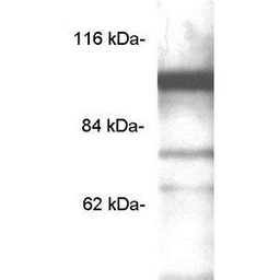 Anti-PDE6C antibody used in Western Blot (WB). GTX17580