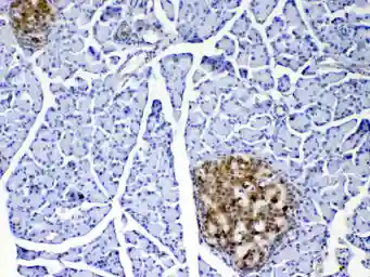 Anti-IL17A antibody used in IHC (Paraffin sections) (IHC-P). GTX17587
