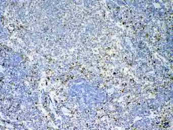 Anti-IL17A antibody used in IHC (Paraffin sections) (IHC-P). GTX17587