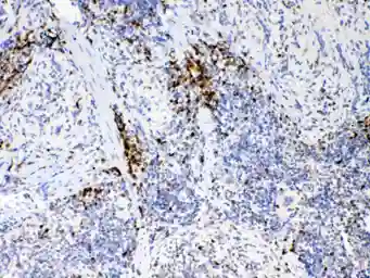 Anti-IL17A antibody used in IHC (Paraffin sections) (IHC-P). GTX17587