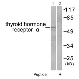 Anti-Thyroid Hormone Receptor alpha antibody used in Western Blot (WB). GTX17590