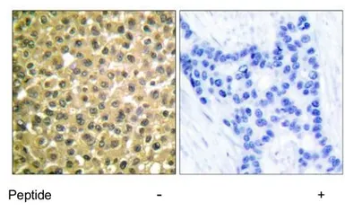 Anti-Retinoic Acid Receptor beta antibody used in IHC (Paraffin sections) (IHC-P). GTX17593