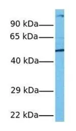 Anti-PXR antibody used in Western Blot (WB). GTX17595