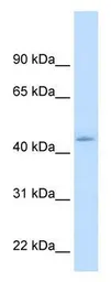 Anti-NR1I3 antibody used in Western Blot (WB). GTX17598