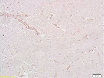 Anti-GLP1R antibody used in IHC (Paraffin sections) (IHC-P). GTX17604