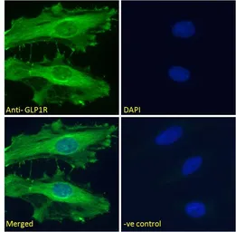 Anti-GLP1R antibody used in Immunocytochemistry/ Immunofluorescence (ICC/IF). GTX17606